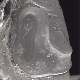Amblyomma humerale, female, bottom spiracle