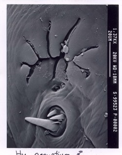 Hyalomma aegyptium, male, leg hallers organ