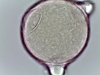 Triosteum perfoliatum, pollen