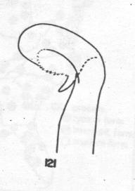Ammophila evansi, male, penis valve head