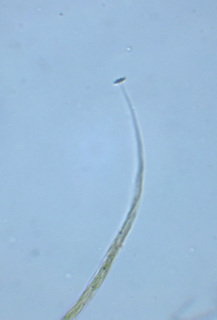 Echinostelium elachiston