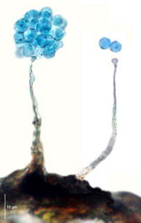 Echinostelium corynophorum