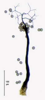 Paradiacheopsis acanthodes