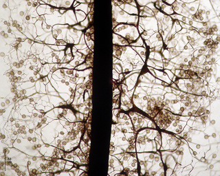 Symphytocarpus amaurochaetoides